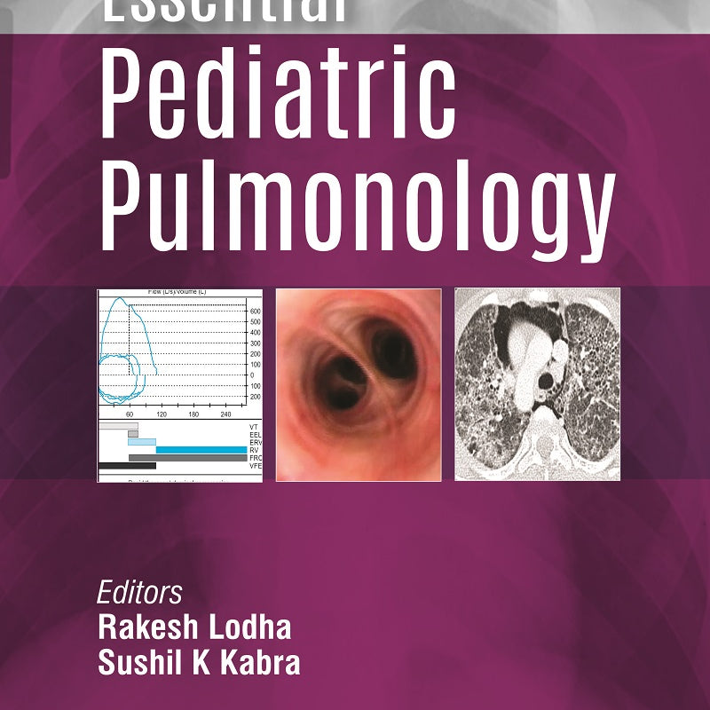 ESSENTIAL PEDIATRIC PULMONOLOGY 4/E, 2023, RAKESH LODHA