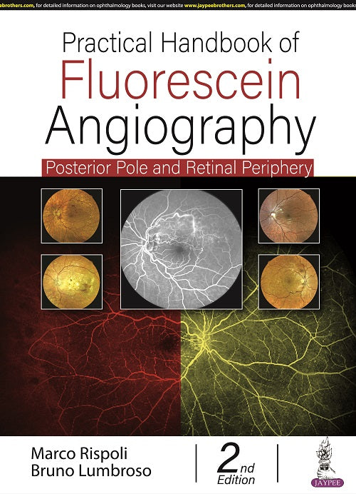 PRACTICAL HANDBOOK OF FLUORESCEIN ANGIOGRAPHY: POSTERIOR AND RETINAL PERIPHERY, 2/E, BY, MARCO RISPOLI