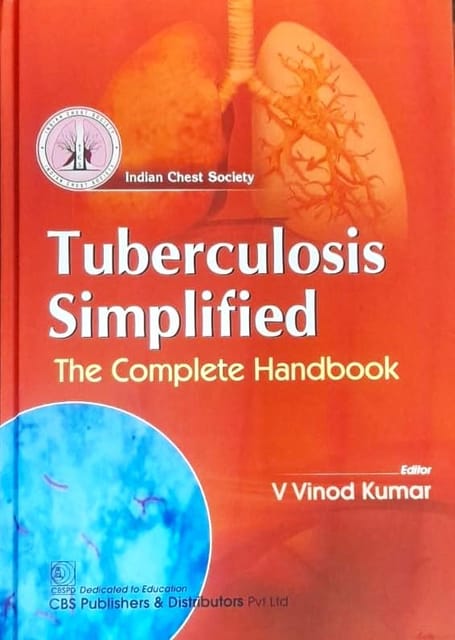 Tuberculosis Simplified 1st/2024 by  V Vinod Kumar