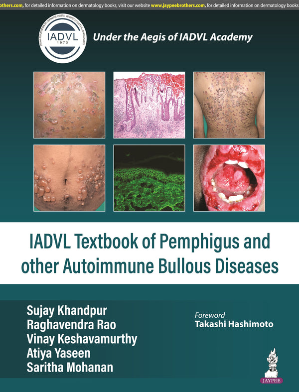 IADVL TEXTBOOK OF PEMPHIGUS AND OTHER AUTOIMMUNE BULLOUS DISEASES, 1/E, BY, SUJAY KHANDPUR