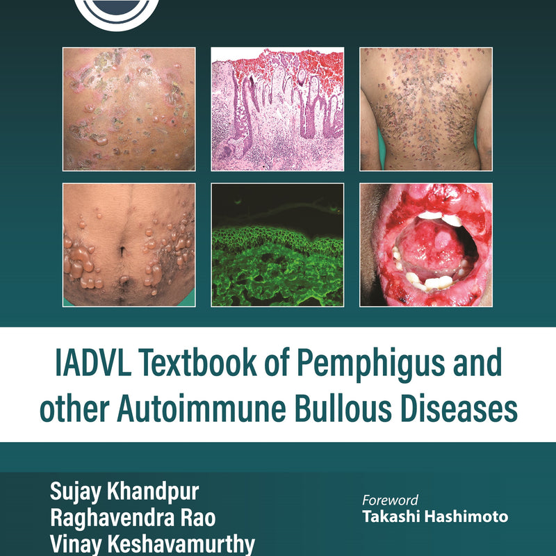 IADVL TEXTBOOK OF PEMPHIGUS AND OTHER AUTOIMMUNE BULLOUS DISEASES, 1/E, BY, SUJAY KHANDPUR