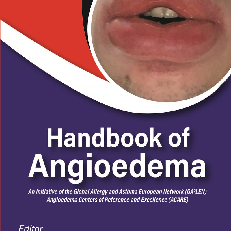 HANDBOOK OF ANGIOEDEMA 1/E, 2024, KIRAN V GODSE