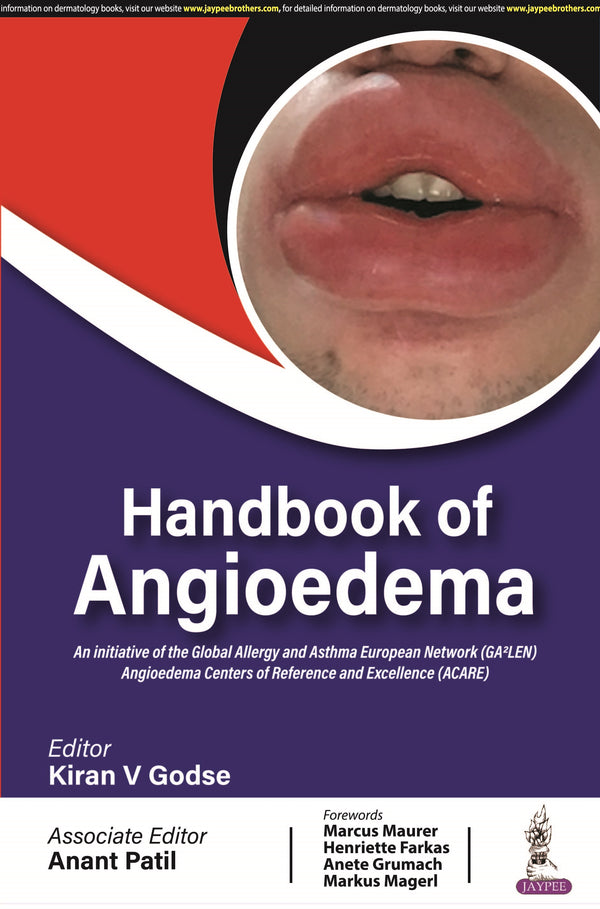 HANDBOOK OF ANGIOEDEMA 1/E, 2024, KIRAN V GODSE