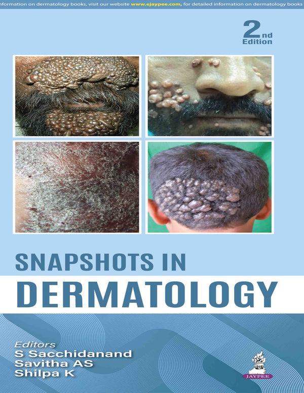SNAPSHOTS IN DERMATOLOGY, 2/E, BY, S SACCHIDANAND