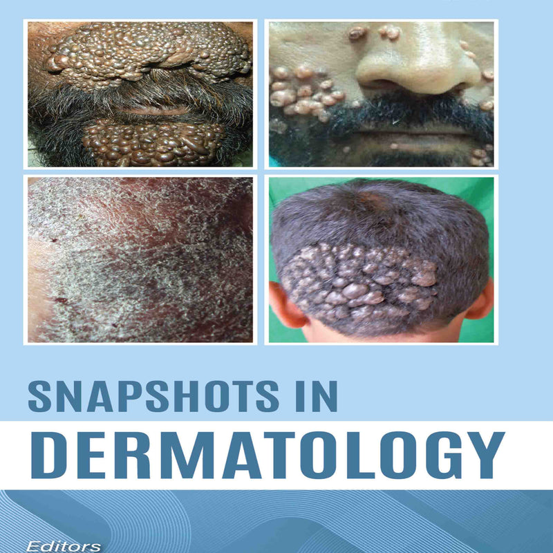 SNAPSHOTS IN DERMATOLOGY, 2/E, BY, S SACCHIDANAND