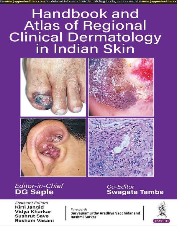 HANDBOOK AND ATLAS OF REGIONAL CLINICAL DERMATOLOGY IN INDIAN SKIN 1/E, 2025, DG SAPLE