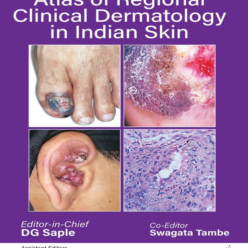 HANDBOOK AND ATLAS OF REGIONAL CLINICAL DERMATOLOGY IN INDIAN SKIN 1/E, 2025, DG SAPLE