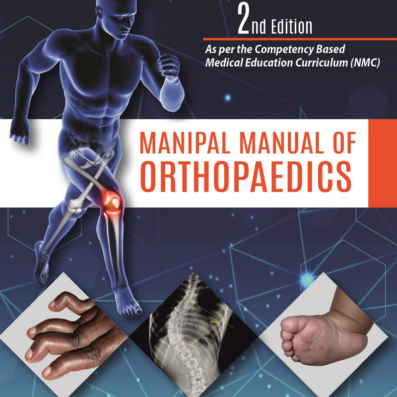 MANIPAL MANUAL OF ORTHOPAEDICS (FREE! COMPLEMENTARY ONLINE ACCESS TO MUSCULOSKELETAL EXAMINATION FOR, 2/E R.P., BY, VIVEK PANDEY