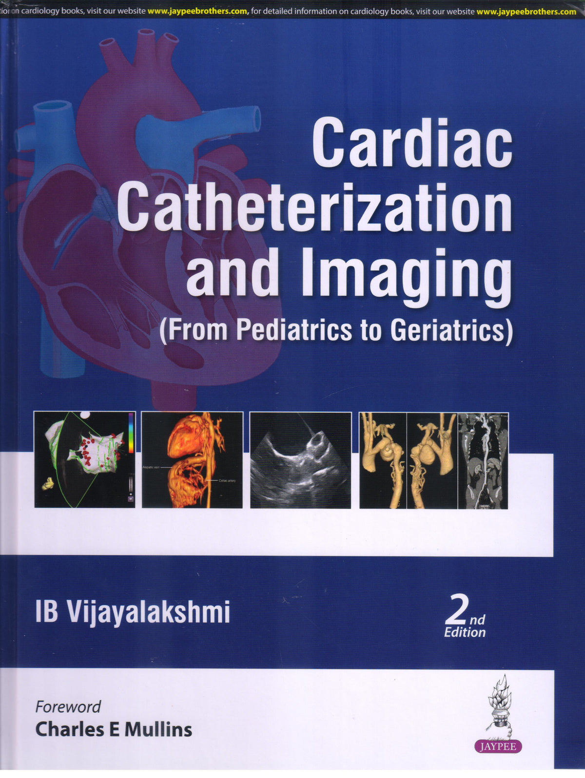 Cardiac Catheterization and Imaging from Pediatrics to Geriatrics 2nd/2024 by IB Vijayalakshmi