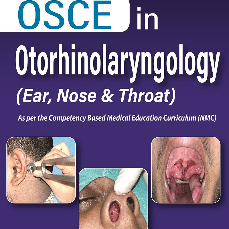 OSCE IN OTORHINOLARYNGOLOGY (EAR, NOSE & THROAT) 1/E, 2023, SUMANTA KUMAR DUTTA