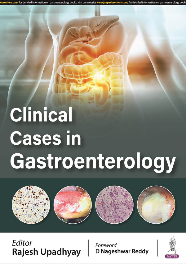 CLINICAL CASES IN GASTROENTEROLOGY, 1/E, BY, RAJESH UPADHYAY