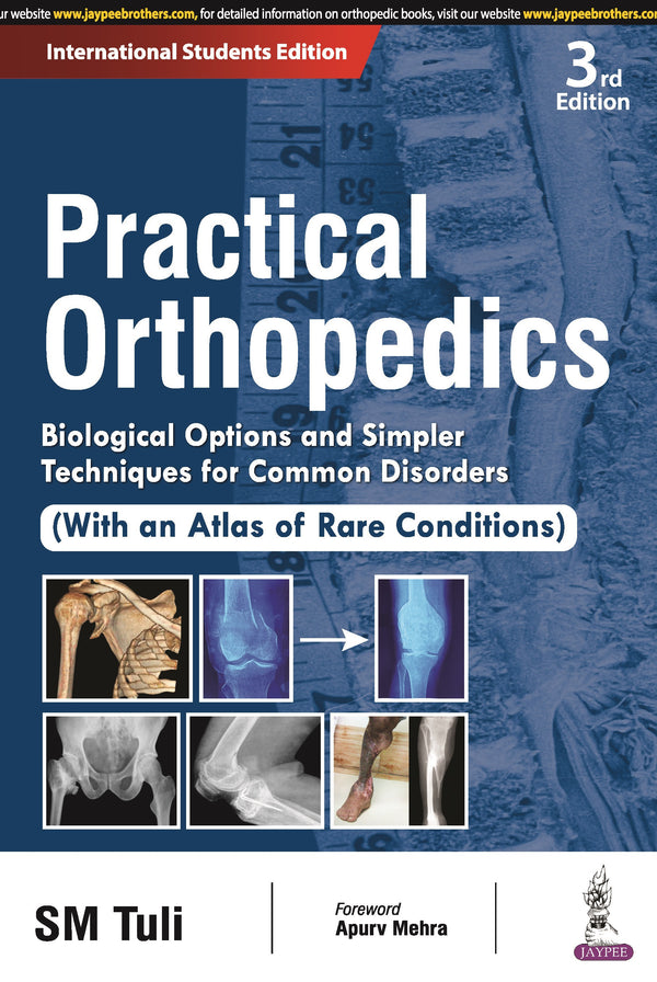 PRACTICAL ORTHOPEDICS: BIOLOGICAL OPTIONS AND SIMPLER TECHNIQUES FOR COMMON DISORDERS (WITH AN ATLAS, 3/E R.P., BY, SM TULI