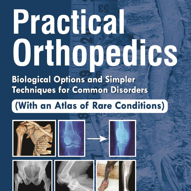PRACTICAL ORTHOPEDICS: BIOLOGICAL OPTIONS AND SIMPLER TECHNIQUES FOR COMMON DISORDERS (WITH AN ATLAS, 3/E R.P., BY, SM TULI