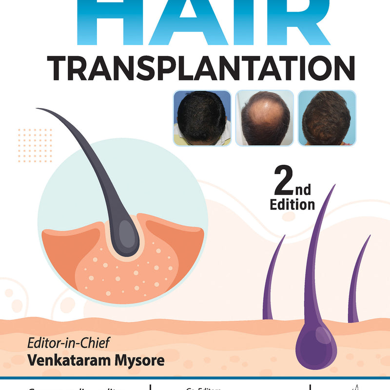 HAIR TRANSPLANTATION 2/E, 2024, VENKATARAM MYSORE