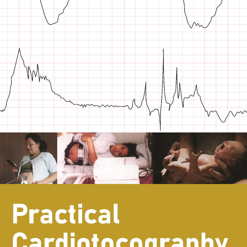 PRACTICAL CARDIOTOCOGRAPHY 4/E, 2024, AK DEBDAS