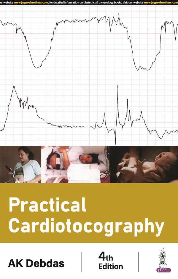 PRACTICAL CARDIOTOCOGRAPHY, 4/E, BY, AK DEBDAS
