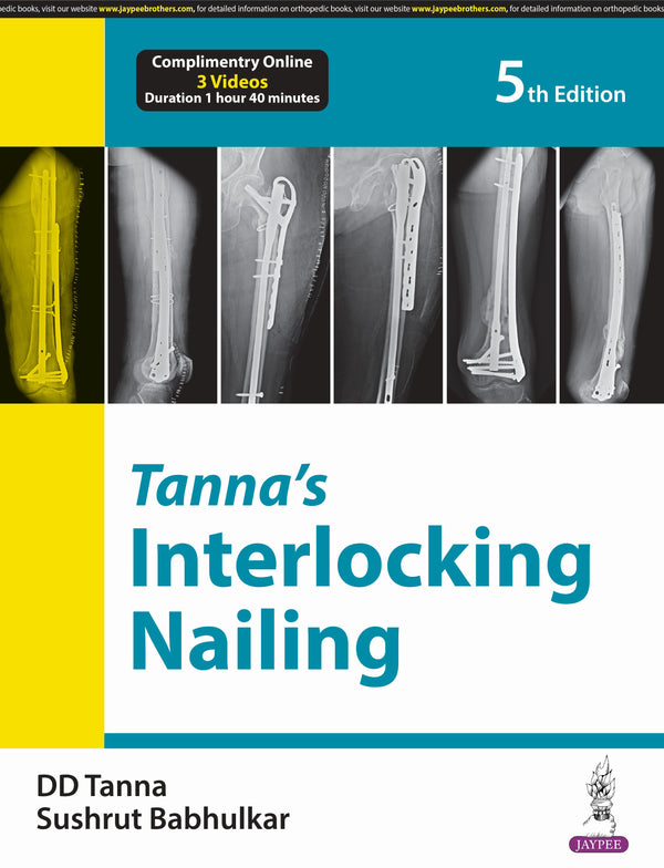 TANNA'S INTERLOCKING NAILING, 5/E, BY, DD TANNA