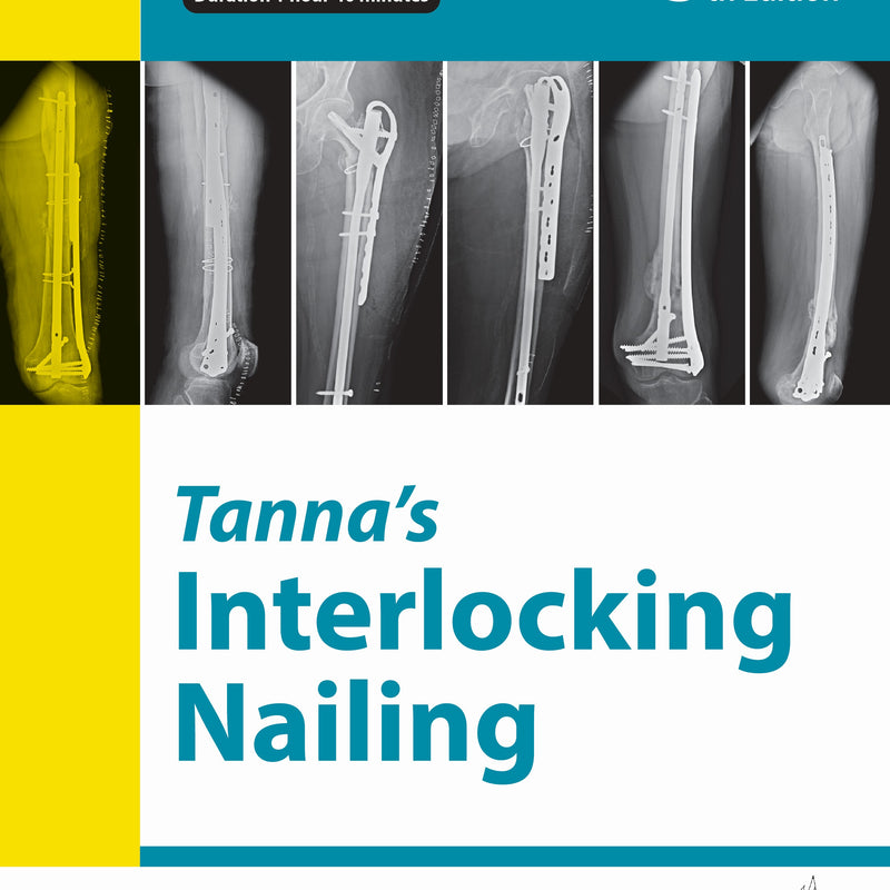 TANNA'S INTERLOCKING NAILING, 5/E, BY, DD TANNA