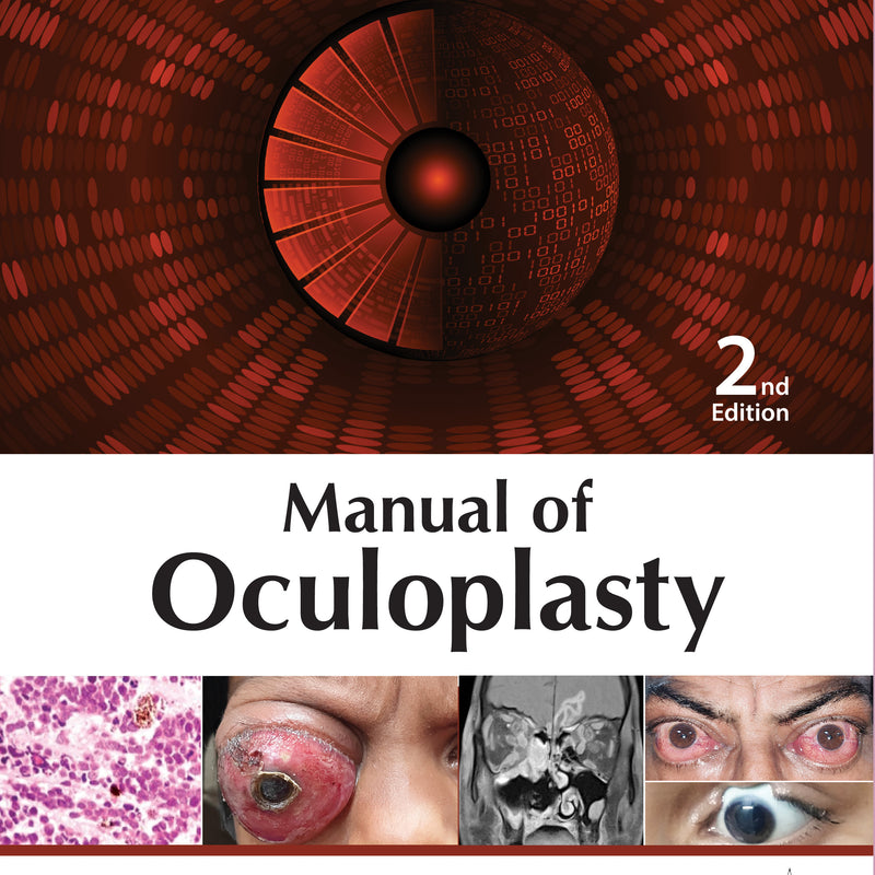 MANUAL OF OCULOPLASTY, 2/E R.P., BY, RUCHI GOEL