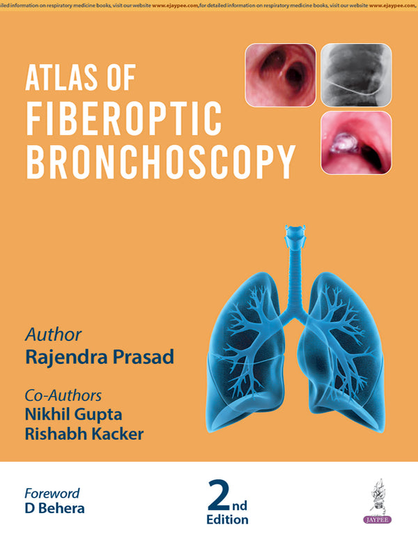 ATLAS OF FIBEROPTIC BRONCHOSCOPY, 2/E, RAJENDRA PRASAD