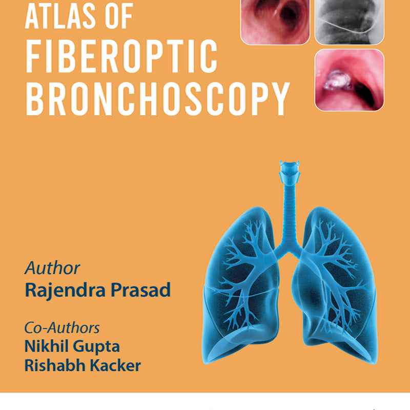 ATLAS OF FIBEROPTIC BRONCHOSCOPY, 2/E, RAJENDRA PRASAD