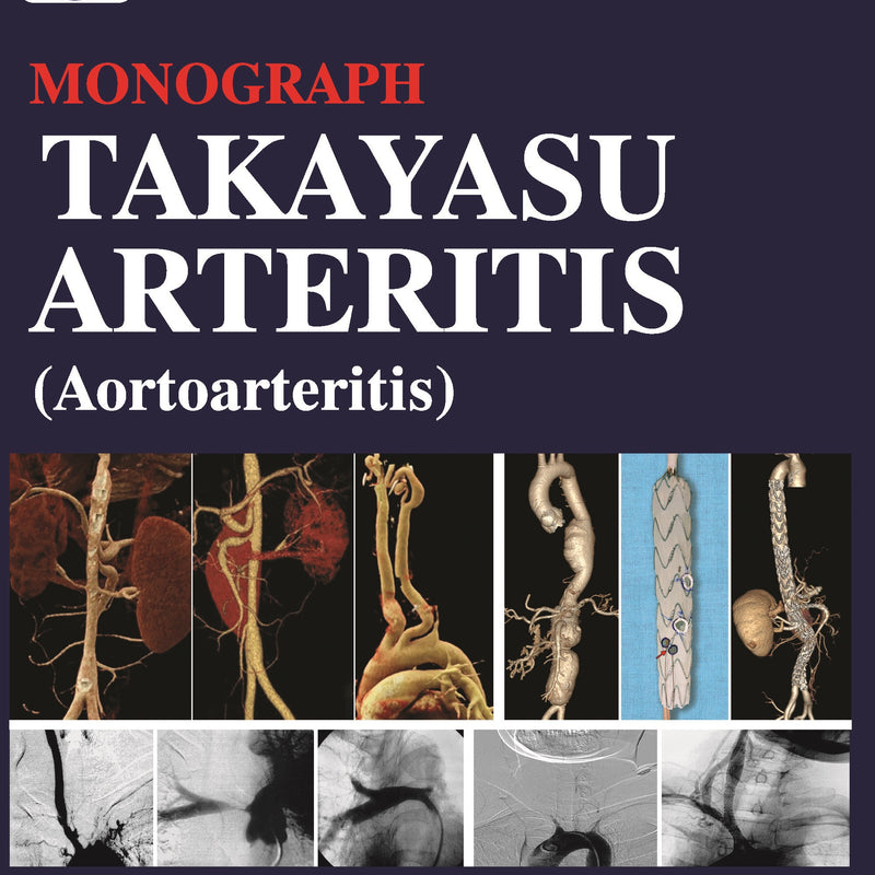 CSI MONOGRAPH TAKAYASU ARTERITIS (AORTOARTERITIS) 1/E, 2024, SANJAY TYAGI