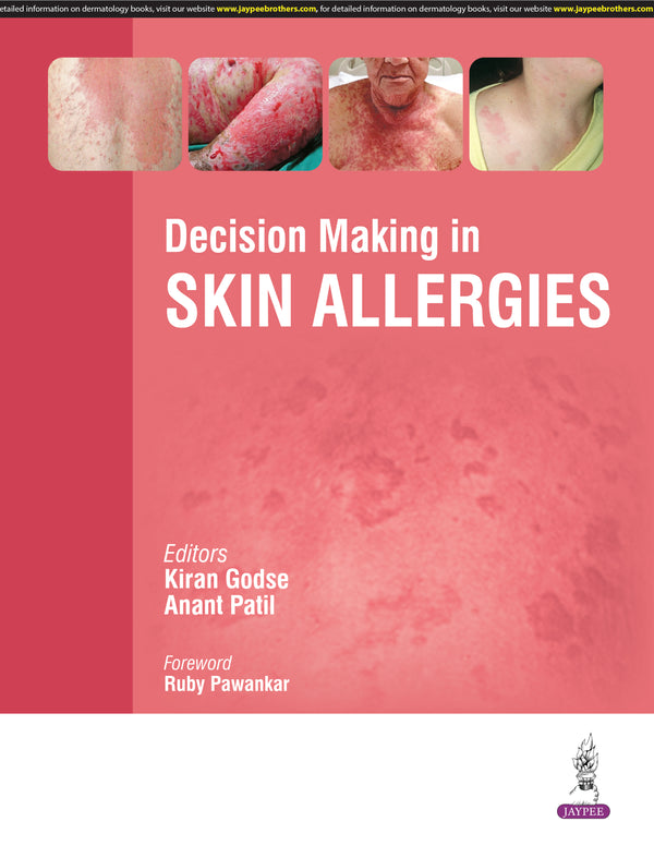DECISION MAKING IN SKIN ALLERGIES, 1/E, BY, KIRAN GODSE