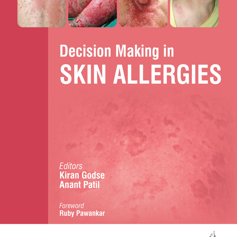 DECISION MAKING IN SKIN ALLERGIES, 1/E, BY, KIRAN GODSE