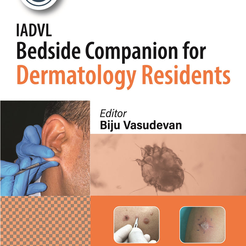 IADVL BEDSIDE COMPANION FOR DERMATOLOGY RESIDENTS 1/E, 2024, BIJU VASUDEVAN