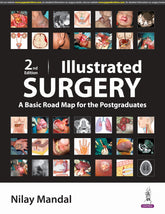 Illustrated Surgery 2nd/2024 by  Nilay Mandal