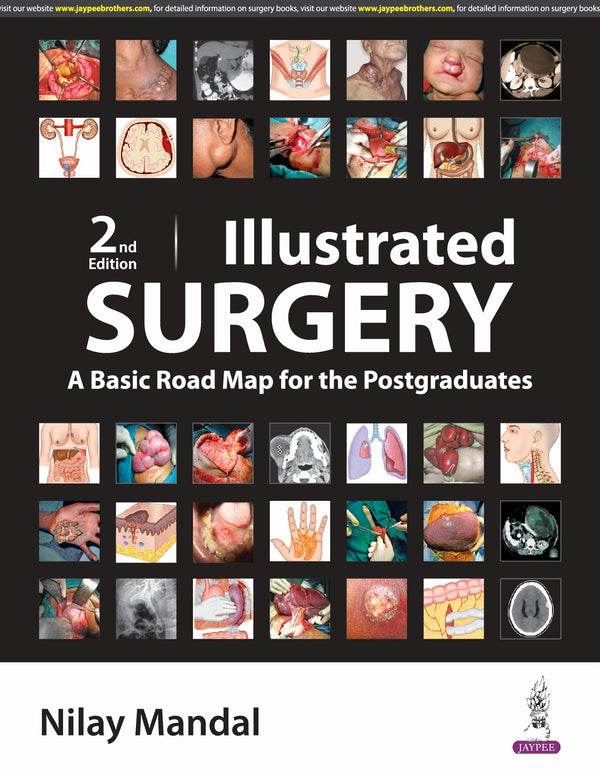 ILLUSTRATED SURGERY A BASIC ROAD MAP FOR THE POSTGRADUATES 2/E, 2024, NILAY MANDAL