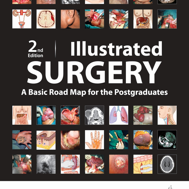 ILLUSTRATED SURGERY A BASIC ROAD MAP FOR THE POSTGRADUATES 2/E, 2024, NILAY MANDAL