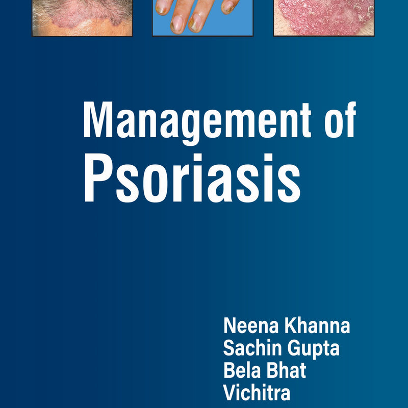 MANAGEMENT OF PSORIASIS, 1/E, BY, NEENA KHANNA