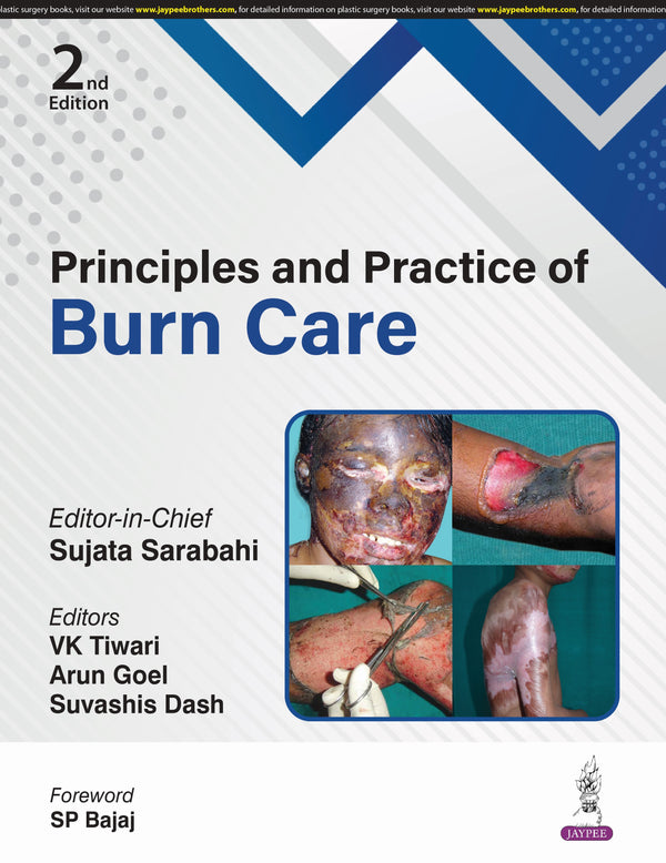 PRINCIPLES AND PRACTICE OF BURN CARE, 2/E, BY, SUJATA SARABAHI