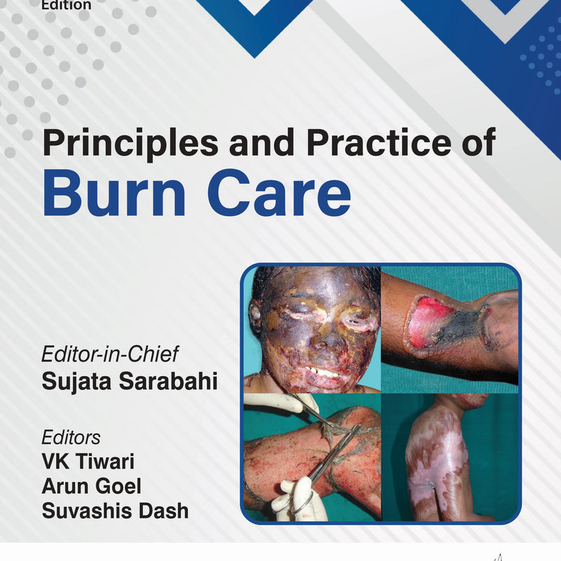 PRINCIPLES AND PRACTICE OF BURN CARE, 2/E, BY, SUJATA SARABAHI