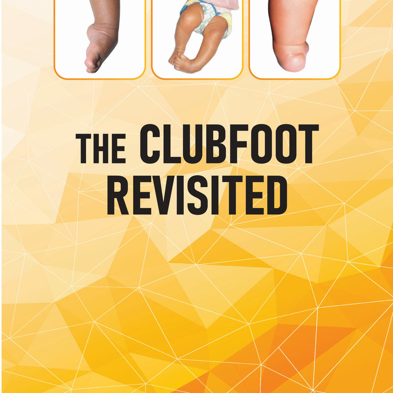 THE CLUBFOOT REVISITED, 2/E, BY, SURESHWAR PANDEY