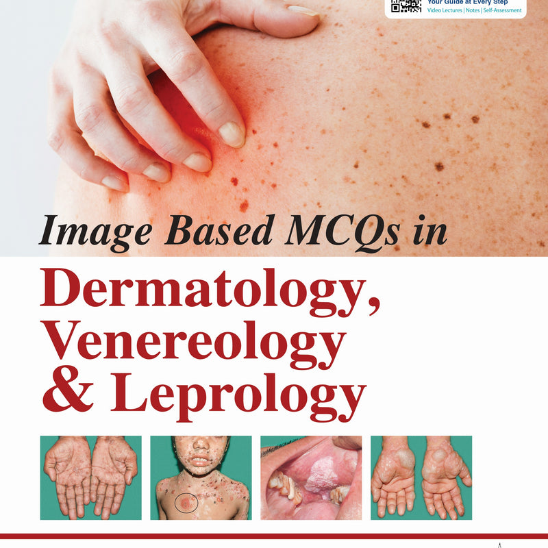 IMAGE BASED MCQ'S IN DERMATOLOGY, VENEREOLOGY & LEPROLOGY, 1/E, BY, RAMESH BANSAL