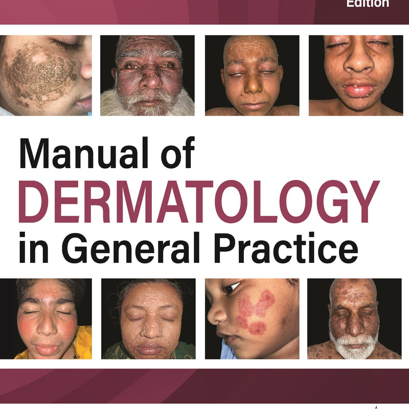 MANUAL OF DERMATOLOGY IN GENERAL PRACTICE, 2/E R.P., BY, PROF DR MD ROKON UDDIN