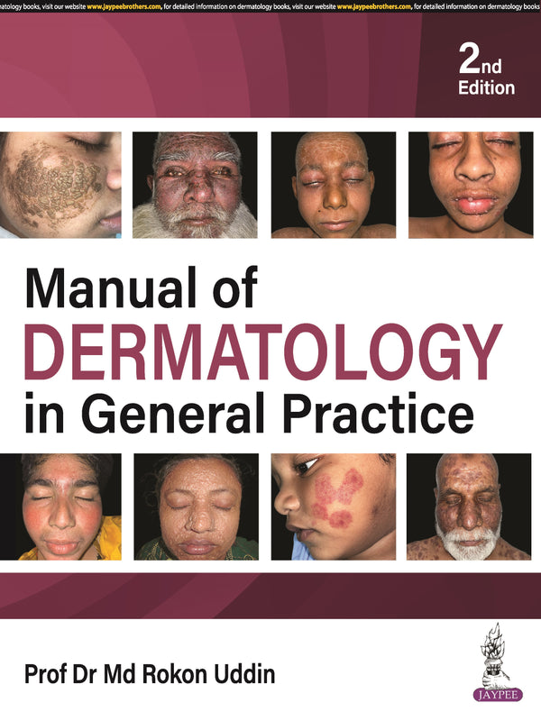MANUAL OF DERMATOLOGY IN GENERAL PRACTICE, 2/E R.P., BY, PROF DR MD ROKON UDDIN