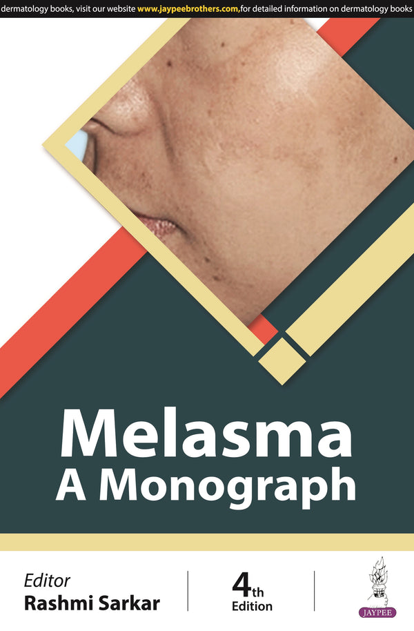 MELASMA: A MONOGRAPH, 4/E, BY, RASHMI SARKAR
