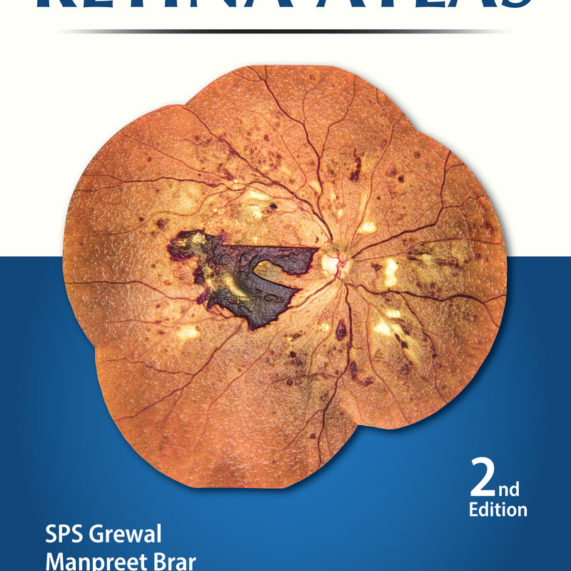 RETINA ATLAS, 2/E, BY, SPS GREWAL