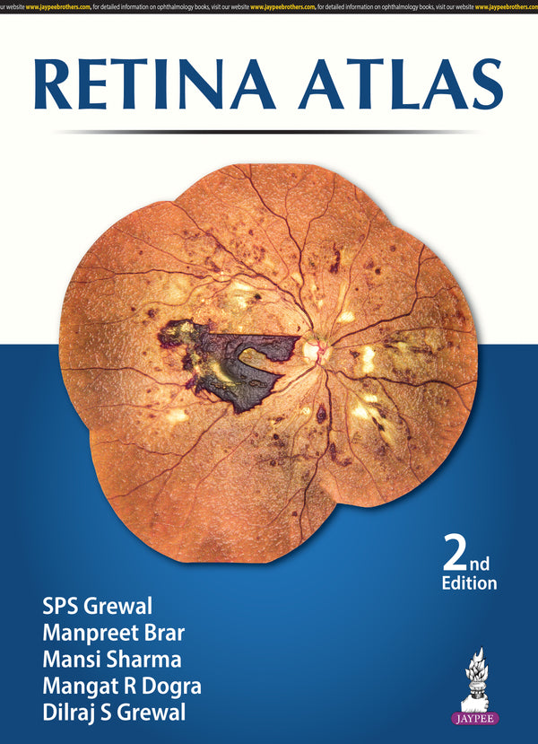 RETINA ATLAS, 2/E, BY, SPS GREWAL
