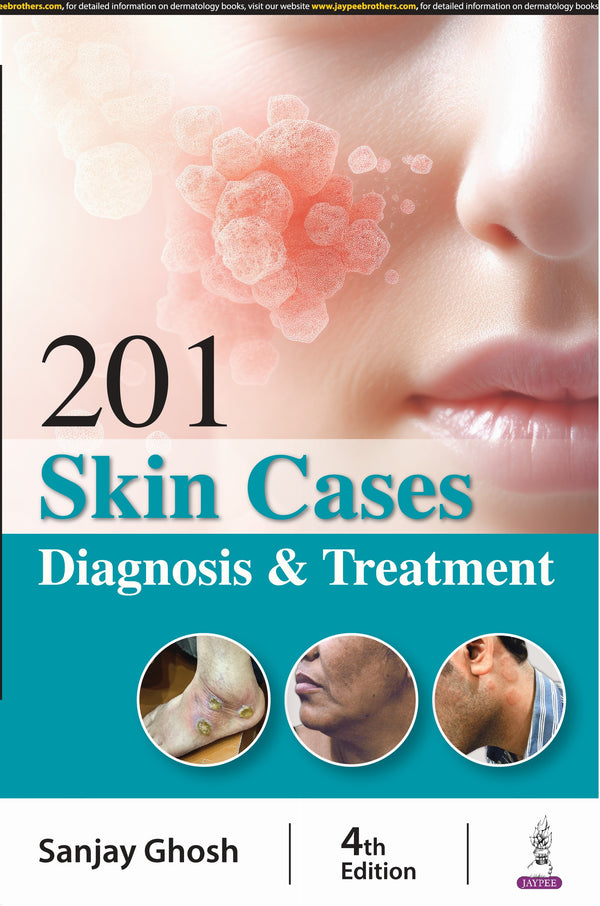 201 SKIN CASES DIAGNOSIS & TREATMENT, 4/E, BY, SANJAY GHOSH