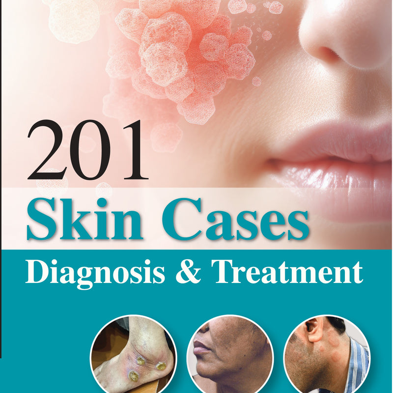 201 SKIN CASES DIAGNOSIS & TREATMENT, 4/E, BY, SANJAY GHOSH