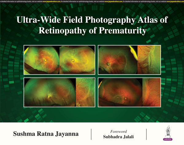 ULTRA- WIDE FIELD PHOTOGRAPHY ATLAS OF RETINOPATHY OF PREMATURITY, 1/E,R.P., SUSHMA RATNA JAYANNA