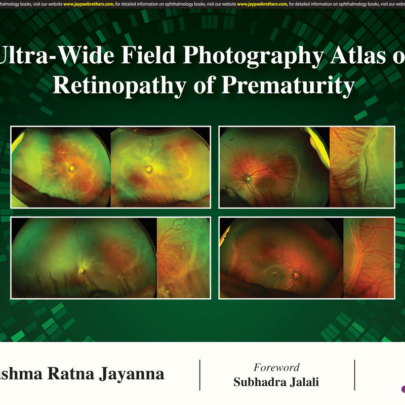 ULTRA- WIDE FIELD PHOTOGRAPHY ATLAS OF RETINOPATHY OF PREMATURITY, 1/E,R.P., SUSHMA RATNA JAYANNA