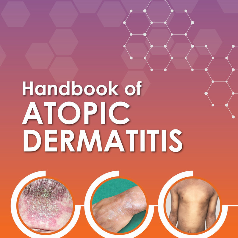 RASHMI SARKAR, HANDBOOK OF ATOPIC DERMATITIS, 1/E, 9789356969650