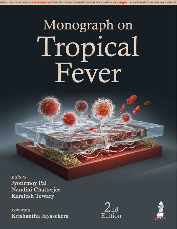 MONOGRAPH ON TROPICAL FEVER, 2/E, JYOTIRMOY PAL