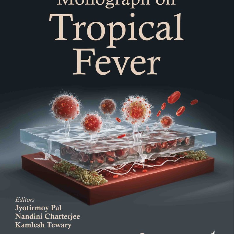 MONOGRAPH ON TROPICAL FEVER, 2/E, JYOTIRMOY PAL