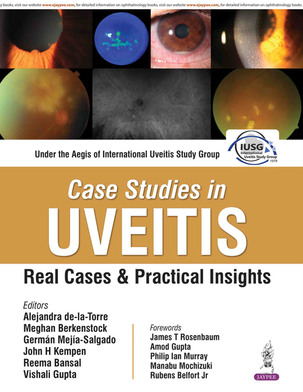 CASE STUDIES IN UVEITIS : REAL CASES AND PRACTICAL INSIGHTS, 1/E, BY, ALEJANDRA DE-LA-TORRE